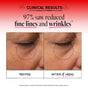 Side-by-side close-ups of skin near an eye, before and after 8 weeks with Derma E Anti-Wrinkle Smoothing Eye Cream. The “after” photo shows fewer fine lines and wrinkles. Text: 97% saw reduced fine lines and wrinkles.