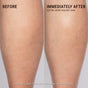 Side-by-side comparison of a person’s calf shows “Before” with dry, rough skin and “Immediately After” using VOESH Resurfacing Sugar Scrub for smoother, more radiant skin. Text notes results from a two-week clinical study.