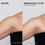 Side-by-side comparison of a woman’s underarm before and after using VOESH Body Balm. Dull skin becomes smoother and glowing. Text highlights results shown in a 2-week clinical study.