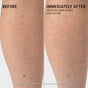 Side-by-side comparison of a person's lower leg labeled Before and Immediately After. The After side, treated with VOESH Body Buffing Bar With AHA, shows smoother texture and fewer KP bumps than the Before side, which is red and bumpy.