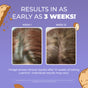 Two side-by-side close-ups show a person's scalp with thicker, fuller hair and visible growth from week 1 to week 12 after using MaryRuth’s Hair Growth Max Liposomal. Promo text notes results in as little as 3 weeks, with floating nut graphics on the image.