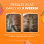 Side-by-side scalp photos labeled Week 1 and Week 12 show visible hair growth after 12 weeks using MaryRuth's Multivitamin + Hair Growth Gummies. Text notes a 3-week improvement, results may vary, with autumn leaves in the background.