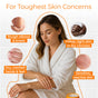 A woman in a white robe applies Tree To Tub Moisturizing Coconut, Cocoa & Shea Butter Body Butter to her arm, surrounded by close-ups of rough elbows, cracked hands, and flakes on dark skin—showing the tough concerns it soothes.