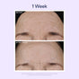 A comparison of forehead wrinkles before and after 1 week of OSEA Dream Night Serum shows a visible reduction in wrinkles in the "After 1 Week" close-up, with both images labeled "Before" and "After 1 Week.