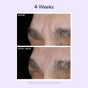 Two close-up images show a person’s eye area before and after 1 week of using OSEA Dream Night Serum. The after image reveals smoother skin and fewer wrinkles above the eyebrow. Text overlay says "4 Weeks.