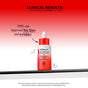 A bottle of Derma E Anti-Wrinkle Retinol Concentrated Serum, formulated with moisturizing hyaluronic acid, showcased against a red gradient background. Text reads: “100% saw improved fine lines and wrinkles,” with clinical study information included in smaller print below.