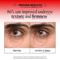 Split image with close-ups of an under-eye area labeled Before and After 4 Weeks, showing smoother skin in the After section. Text above reads: 86% saw improved undereye texture and firmness after using Derma E Retinol Line Smoothing Hydro Gel Patches.