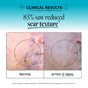 Side-by-side photos of a person’s cheek show reduced scar texture after 4 weeks, with a visible improvement noted in the after image. Text above states 85% saw reduced scar texture using Derma E Scar Gel to improve scar appearance.