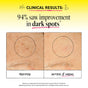 Side-by-side images of skin display dark spots before and after 8 weeks. Text: Clinical Results: 94% saw improvement in dark spots. The after image reveals lighter, less noticeable dark spots—thanks to the powerful benefits of Derma E Vitamin C Intense Night Cream.