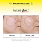 Side-by-side close-up of a cheek, labeled before and after I use Derma E Vitamin C Glow Oil. The after side appears smoother and more radiant, revealing glowing skin. Text above reads: Proven results with Derma E Vitamin C Glow Oil: instant glow!.