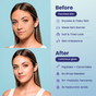 Split image of a woman before and after using FaceTory Dewy Night Hydrating Sleep Mask. Before: dry, dull skin. After: glowing, healthy skin thanks to hydration, a stronger barrier, and ceramides for radiant results.