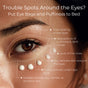 A close-up shows a woman’s eye area with Anti-Aging Retinol Eye Cream for Sensitive Skin dots, highlighting concerns like puffiness, dark circles, fine lines, dryness, uneven tone & suitability for all skin types by Tree To Tub.