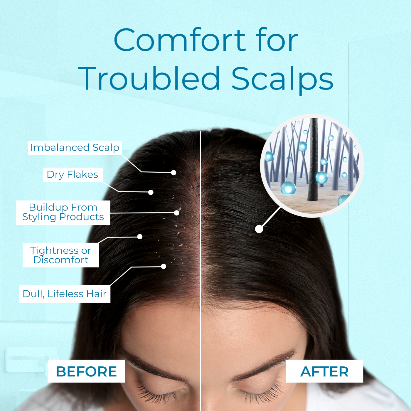 Tree To Tub Tea Tree Scalp Spray - Thumbnail 5