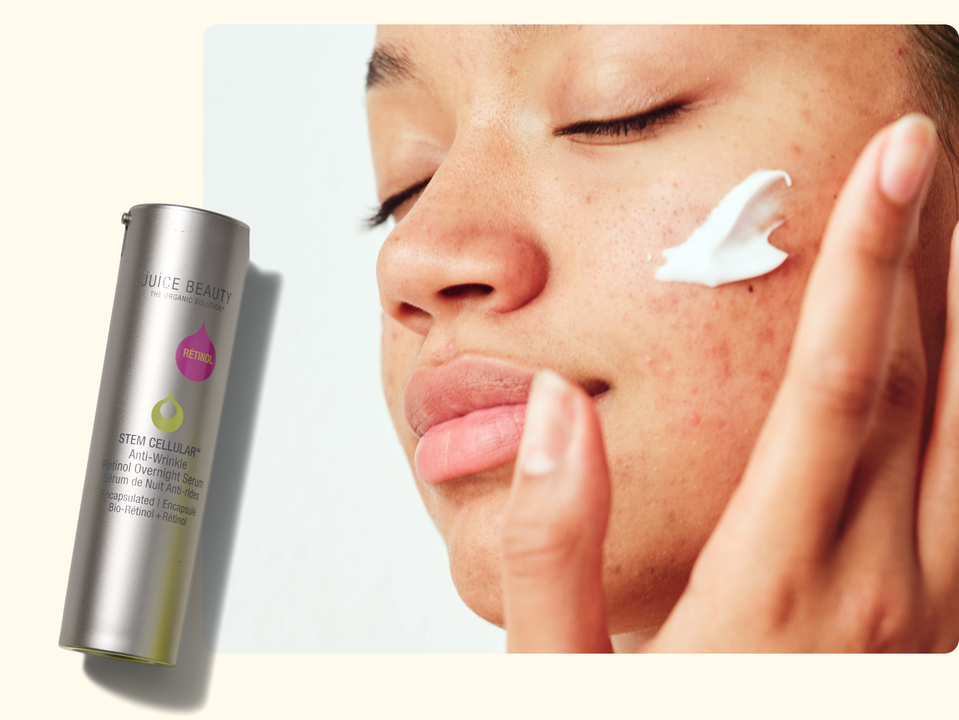 A person with visible acne applies a white cream to their cheek. Next to the face is a gray bottle labeled “Juice Beauty Stem Cellular Anti-Wrinkle Retinol Overnight Serum.” The background is light beige.