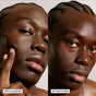 In the left image labeled Application, a person with cornrows applies Freaks of Natures Moisturizer Serum to their cheek. The right image, labeled After 5 Min, shows a smoother complexion enhanced by the serum.
