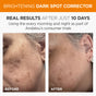 Before and after comparison of a woman's face showing the effects of a dark spot corrector. The 